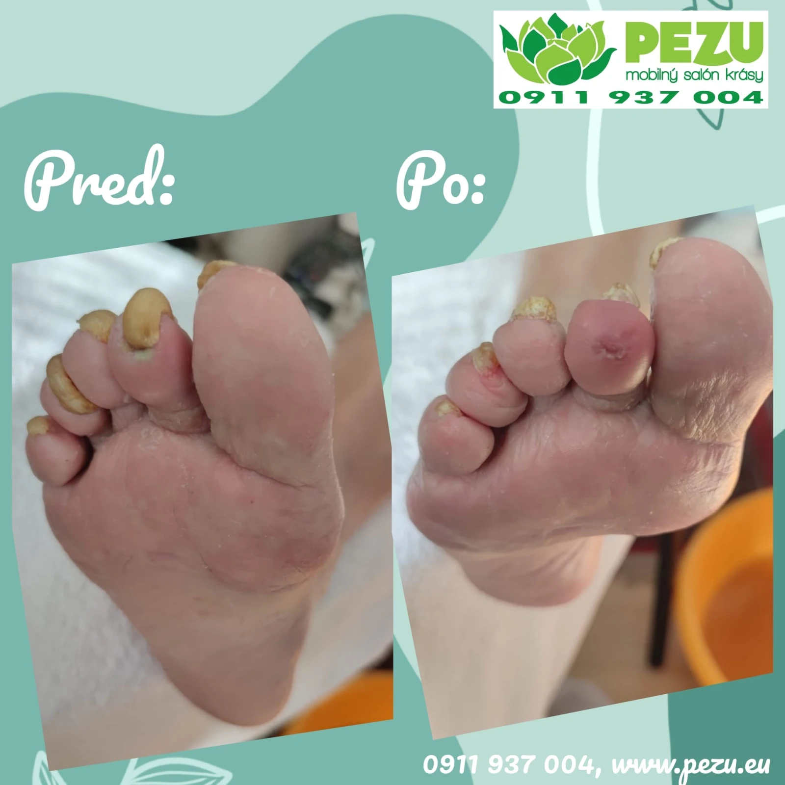 Mokrá pedikúra – ošetrenie chodidiel doma Bratislava